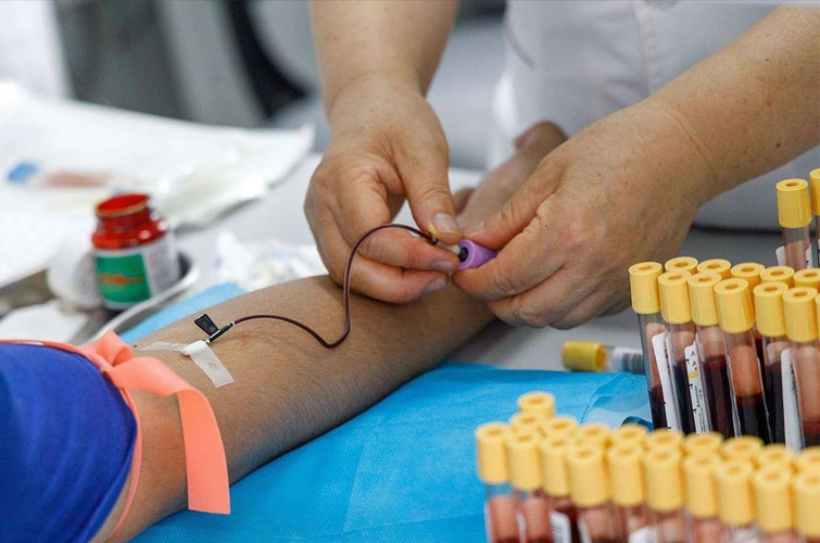 明天抽血查血脂今晚能进食吗？